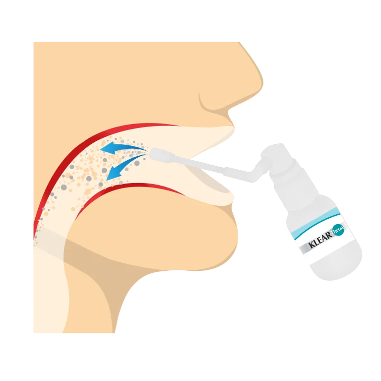 ilustracja KLEAR Throat Arkonadent